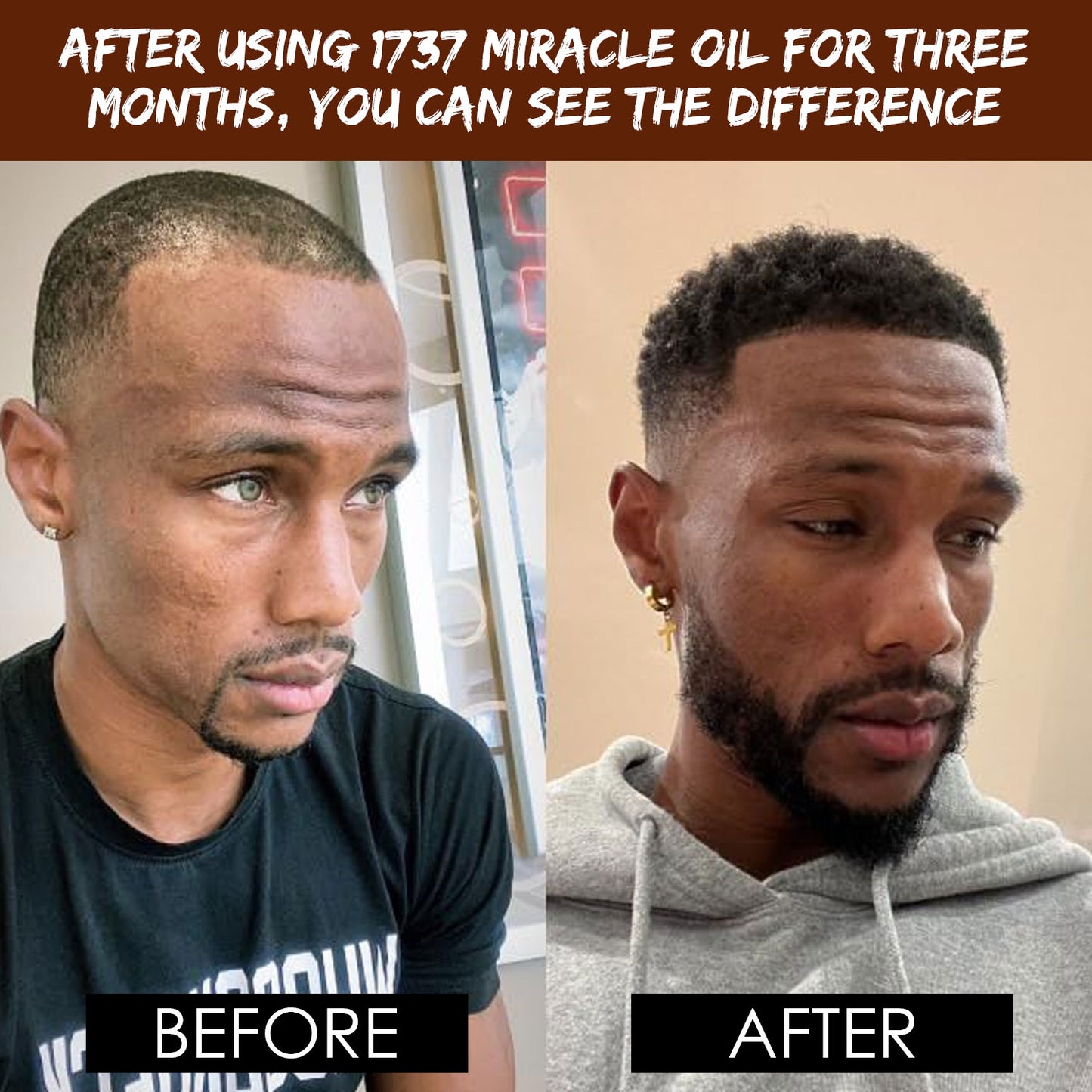 1737 Miracle Oil (Fresh)